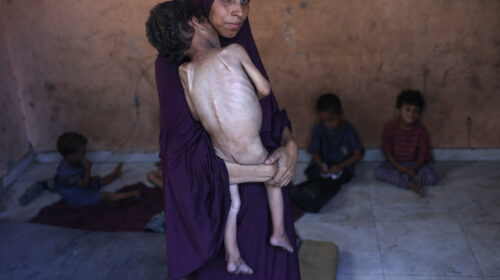 Naeema, una madre palestina de 30 años, carga a su hijo Yazan, de 2 años, desnutrido, mientras permanecen en su casa dañada en el campo de refugiados de Al-Shati, al oeste de la ciudad de Gaza, el 23 de julio de 2025.